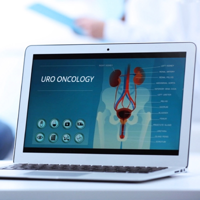 Uro oncology
